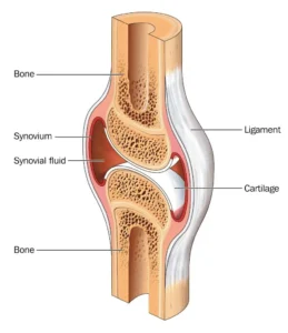 transient synovitis