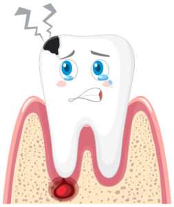 Tooth Eruption