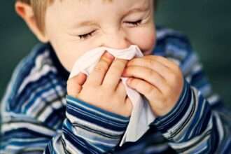 Epistaxis in children