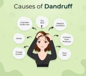 Dandruff in children