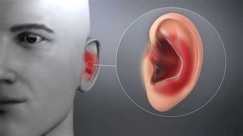 Ear Infection