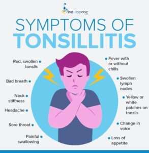 Symptoms of Tonsillitis